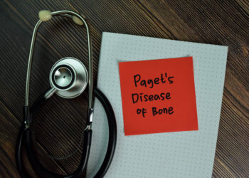 Kaulų Pageto liga: simptomai, priežastys ir gydymas