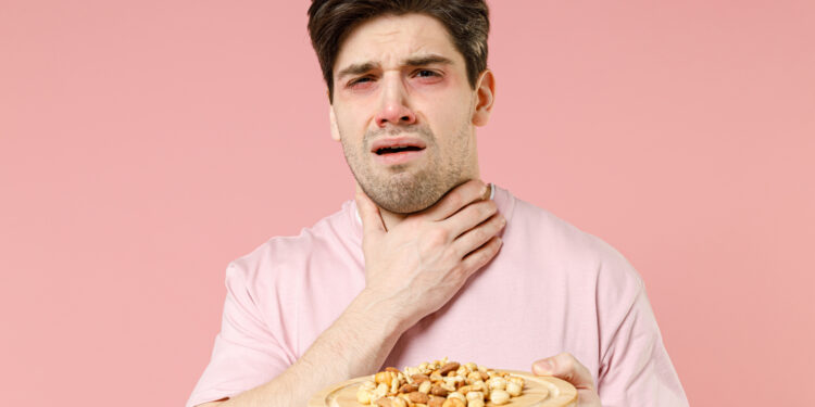 Kodėl žmonės alergiški riešutams?