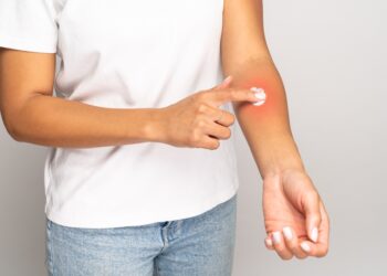 Pirmojo kąsnio sindromas: simptomai, priežastys ir gydymas