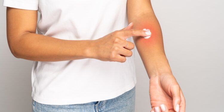 Pirmojo kąsnio sindromas: simptomai, priežastys ir gydymas