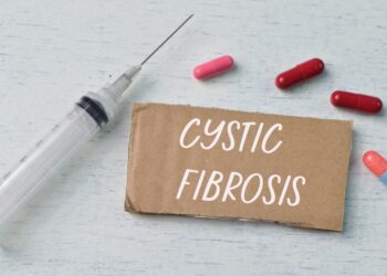 Kas yra kasos išsiskyrimas: simptomai, diagnostika ir gydymas