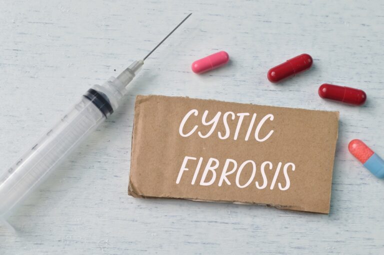 Kas yra kasos išsiskyrimas: simptomai, diagnostika ir gydymas