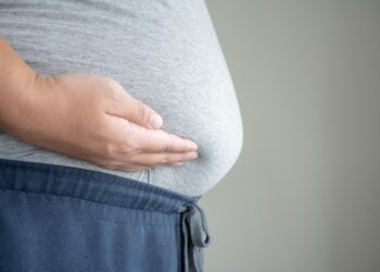 Viršsvoris: kas tai, požymiai, sveikatos rizikos ir šalutiniai poveikiai