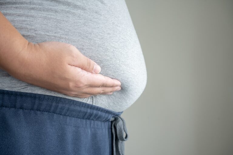 Viršsvoris: kas tai, požymiai, sveikatos rizikos ir šalutiniai poveikiai
