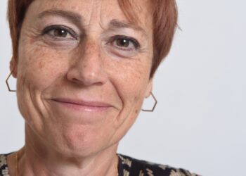 Senatvinės dėmės: priežastys, simptomai ir gydymas