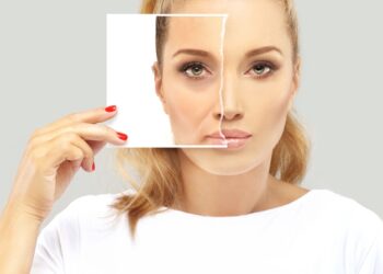 Marionečių linijos: kas tai, priežastys, užpildai ir gydymo būdai