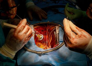 Pratekantis širdies vožtuvas: simptomai, priežastys ir gydymas