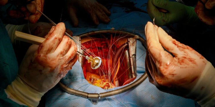 Pratekantis širdies vožtuvas: simptomai, priežastys ir gydymas