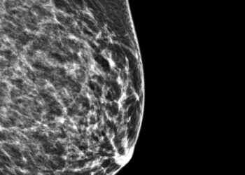 Filoidiniai navikai: tipai, simptomai ir gydymas