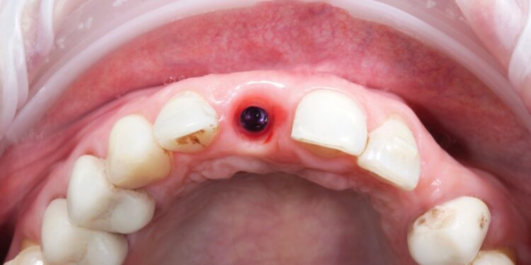 Švinavimas: priežastys, simptomai, tyrimai ir profilaktika