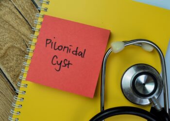 Pilonidinė cista: priežastys, simptomai, gydymas ir šalinimas