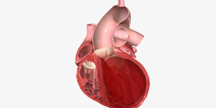Atvira ovalioji anga (PFO): simptomai, priežastys ir gydymas