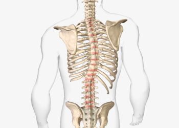 Marfano sindromas: kaip jis veikia širdį