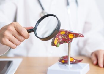 Kuris gydytojas gydo suriebėjusią kepenų ligą?