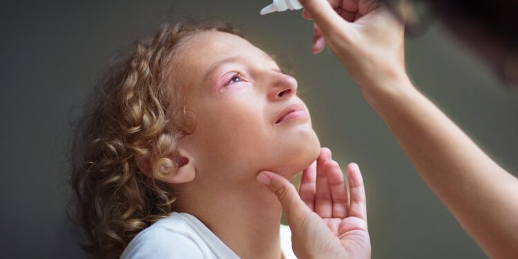 Akių sifilis: simptomai ir gydymas