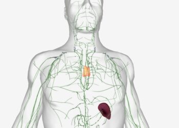 Mantijos zonos limfoma: simptomai, gydymas ir prognozė
