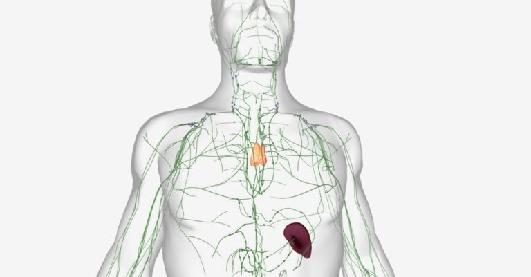 Mantijos zonos limfoma: simptomai, gydymas ir prognozė