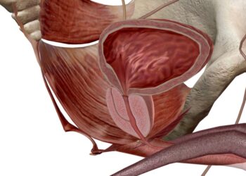 Vidurinio lanko raiščio sindromas (MALS): simptomai ir diagnostika