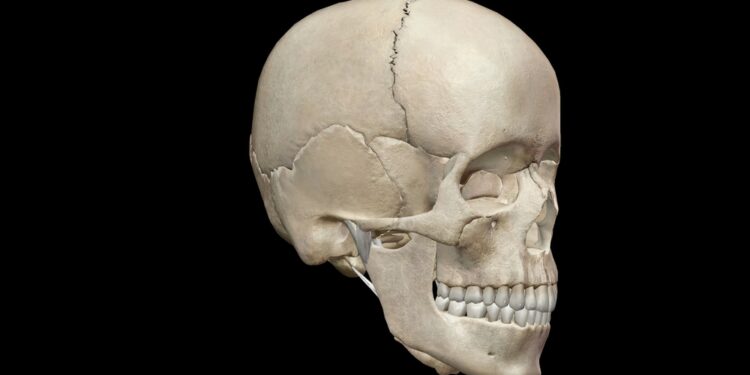 Metopinė kraniosinostozė: kas tai, simptomai ir gydymas