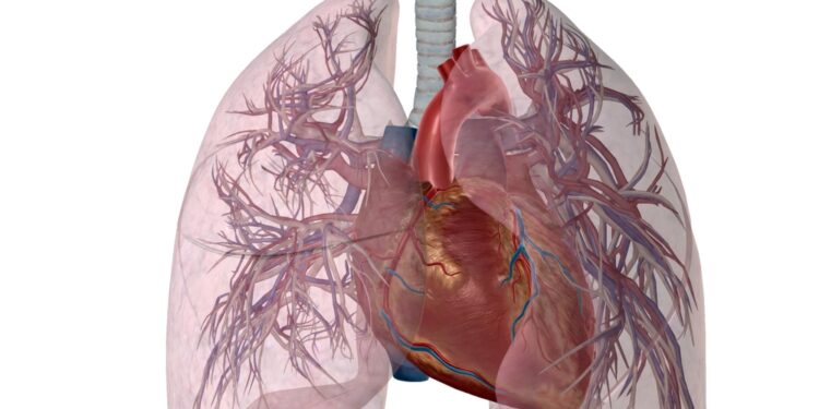 Naujagimių nuolatinė plautinė hipertenzija