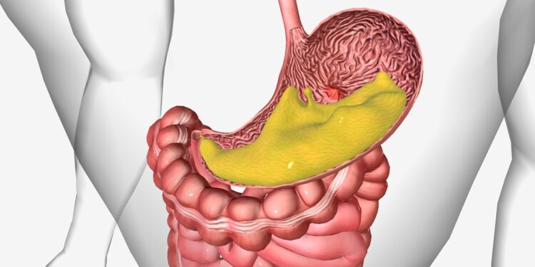 Mezenterinių limfmazgių uždegimas: simptomai, priežastys, tyrimai ir gydymas