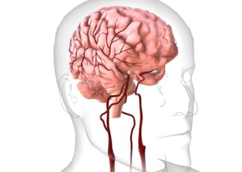Didelės grėsmės glijoma: simptomai, apibrėžtis ir prognozė
