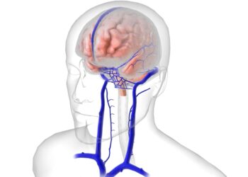 Viršutinė skydinės arterija