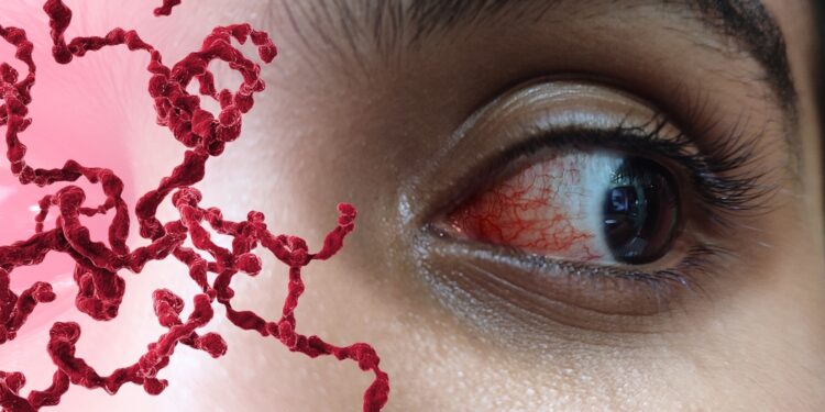 Akių rožinė: simptomai, priežastys, valdymas ir gydymas