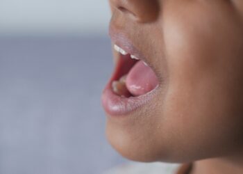 Prieausinės liaukos uždegimas: priežastys, simptomai ir gydymas