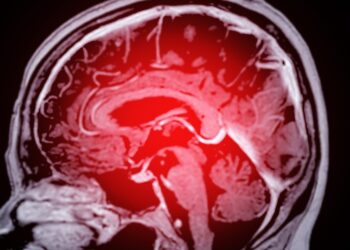 Kraujavimas į smegenis: kas tai, požymiai ir gydymas