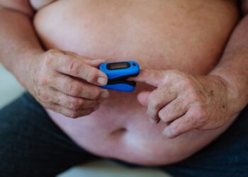 Nutukimo hipoventiliacijos sindromas (OHS): simptomai ir gydymas