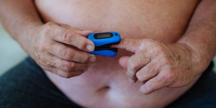 Nutukimo hipoventiliacijos sindromas (OHS): simptomai ir gydymas