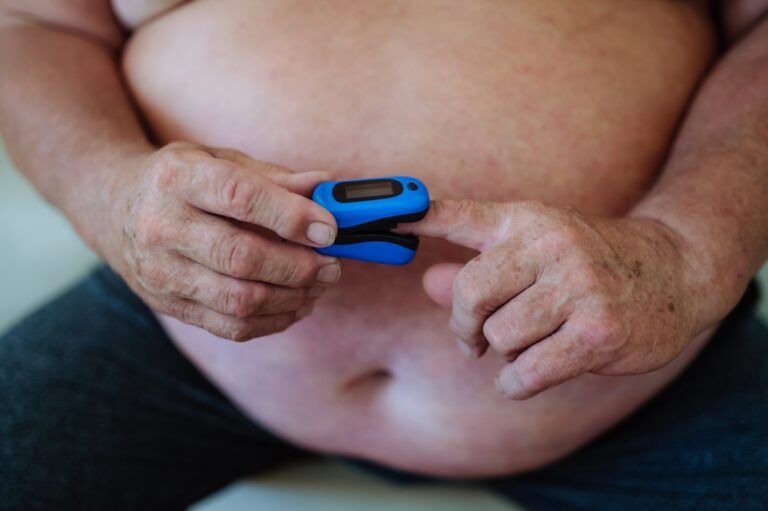 Nutukimo hipoventiliacijos sindromas (OHS): simptomai ir gydymas