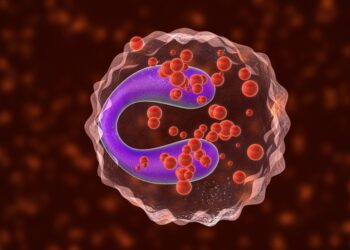 Mastocitozė: tipai, simptomai ir gydymas