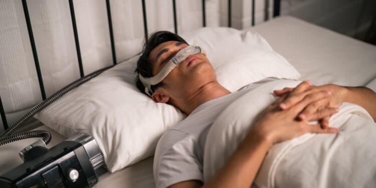 Obstrukcinė miego apnėja (OMA): simptomai ir gydymas