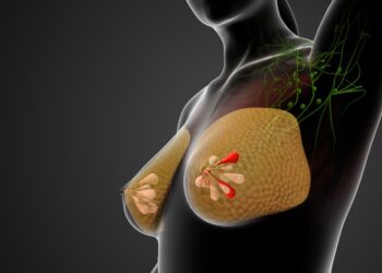 Spenelių įtrūkimai: priežastys, simptomai, diagnostika ir gydymas