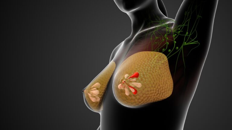 Spenelių įtrūkimai: priežastys, simptomai, diagnostika ir gydymas