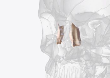 Akiduobės lūžiai: priežastys, simptomai ir gydymas