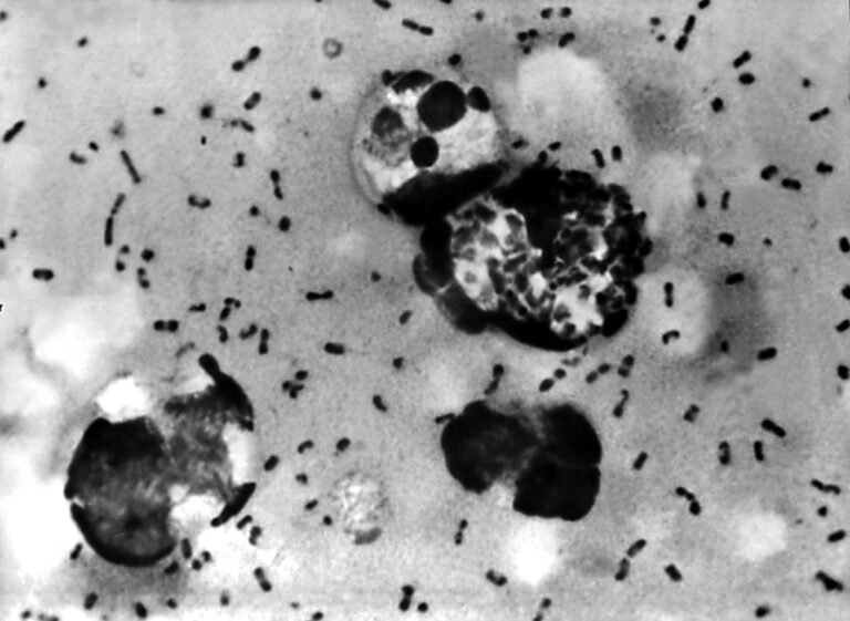 HTLV-1: infekcija, perdavimas, diagnostika ir prevencija