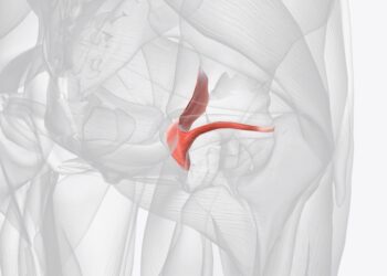 Obturatoriaus išvarža: simptomai, priežastys, diagnostika ir gydymas