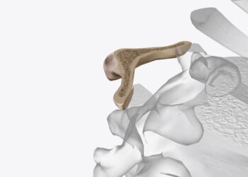 T11 slankstelis: vieta, ypatumai ir funkcijos stubure