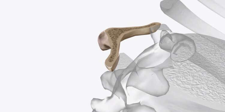 T11 slankstelis: vieta, ypatumai ir funkcijos stubure