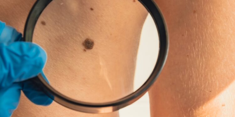 Piktybinis navikas: kas tai, rūšys ir rizikos veiksniai