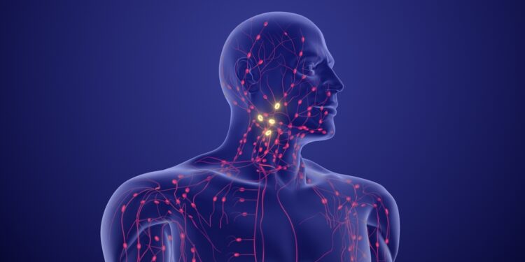 Hodžkino limfoma: simptomai, priežastys ir gydymas