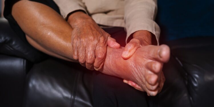 Naktiniai kojų mėšlungiai: priežastys, skausmo malšinimas ir prevencija