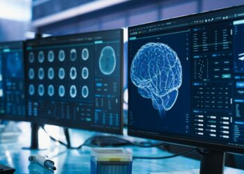 Glioma: kas tai, priežastys, simptomai, gydymas ir prognozė
