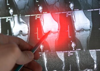 Skaidulinė displazija: kas tai, tipai, simptomai ir gydymas