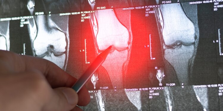 Skaidulinė displazija: kas tai, tipai, simptomai ir gydymas