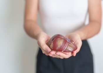 Kas yra su metaboliniais sutrikimais susijusi steatohepatitas?