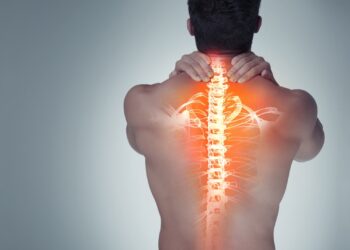 Idiopatinė skoliozė